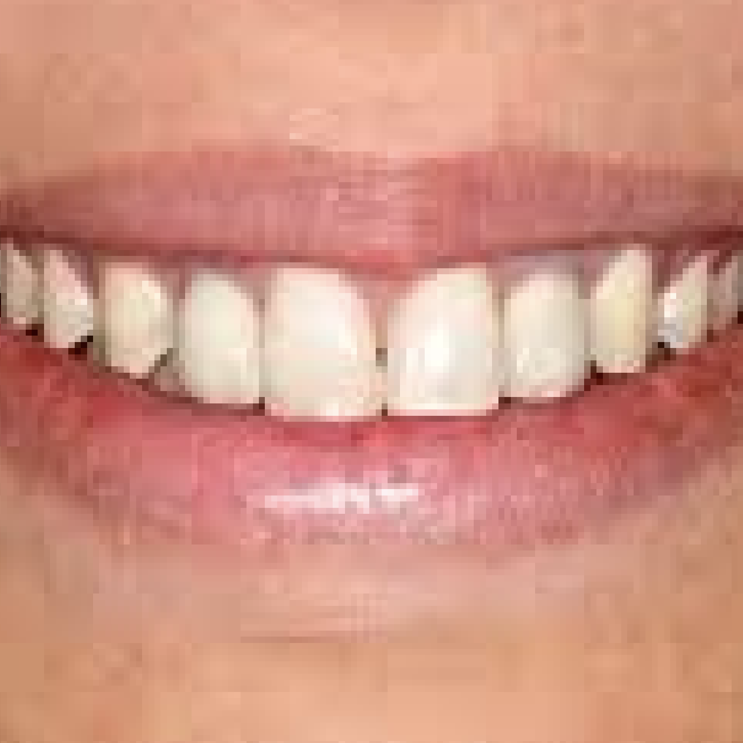 ٠١زراعة بعد