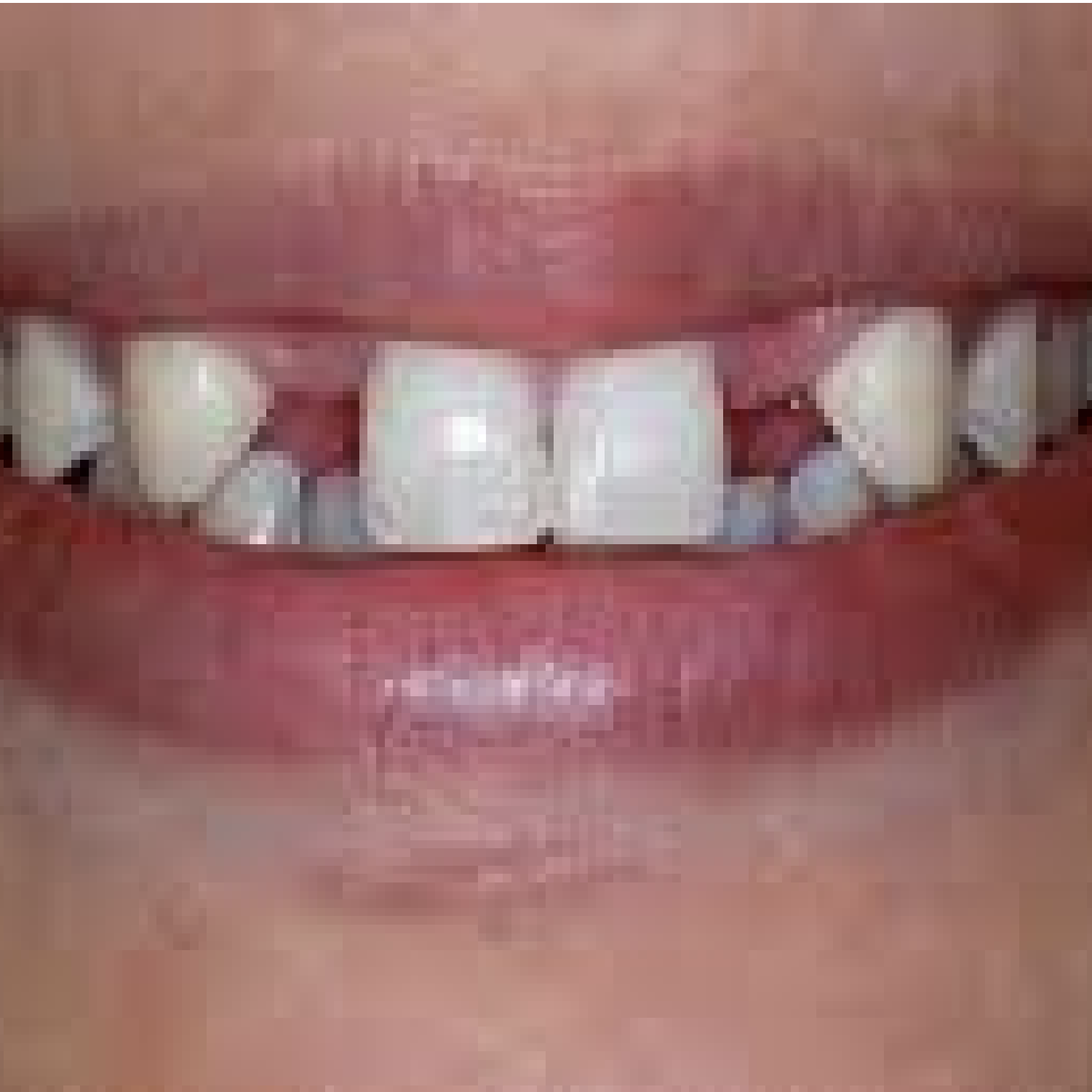 ٠١زراعة قبل